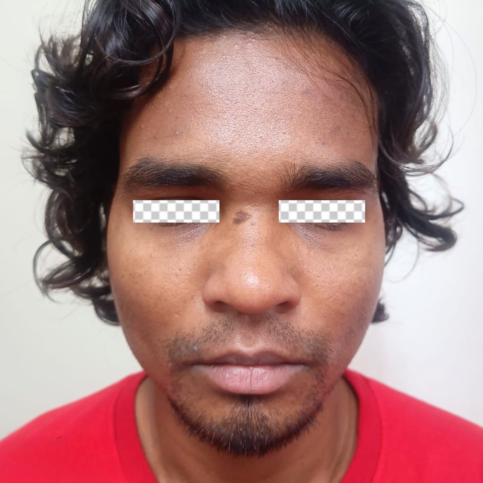 Nose 1